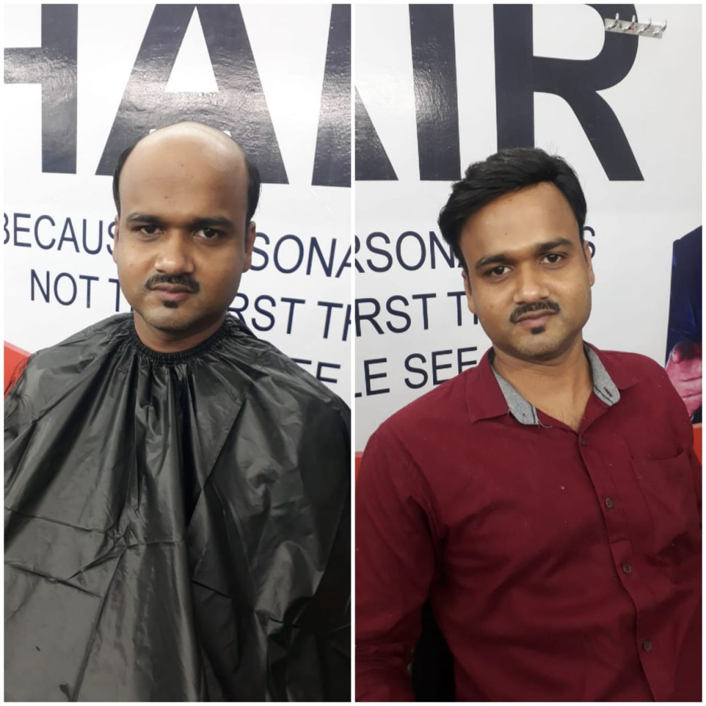 Hair Fix Solution,best hair fixing service in cuttack,bhubaneswar,odisha