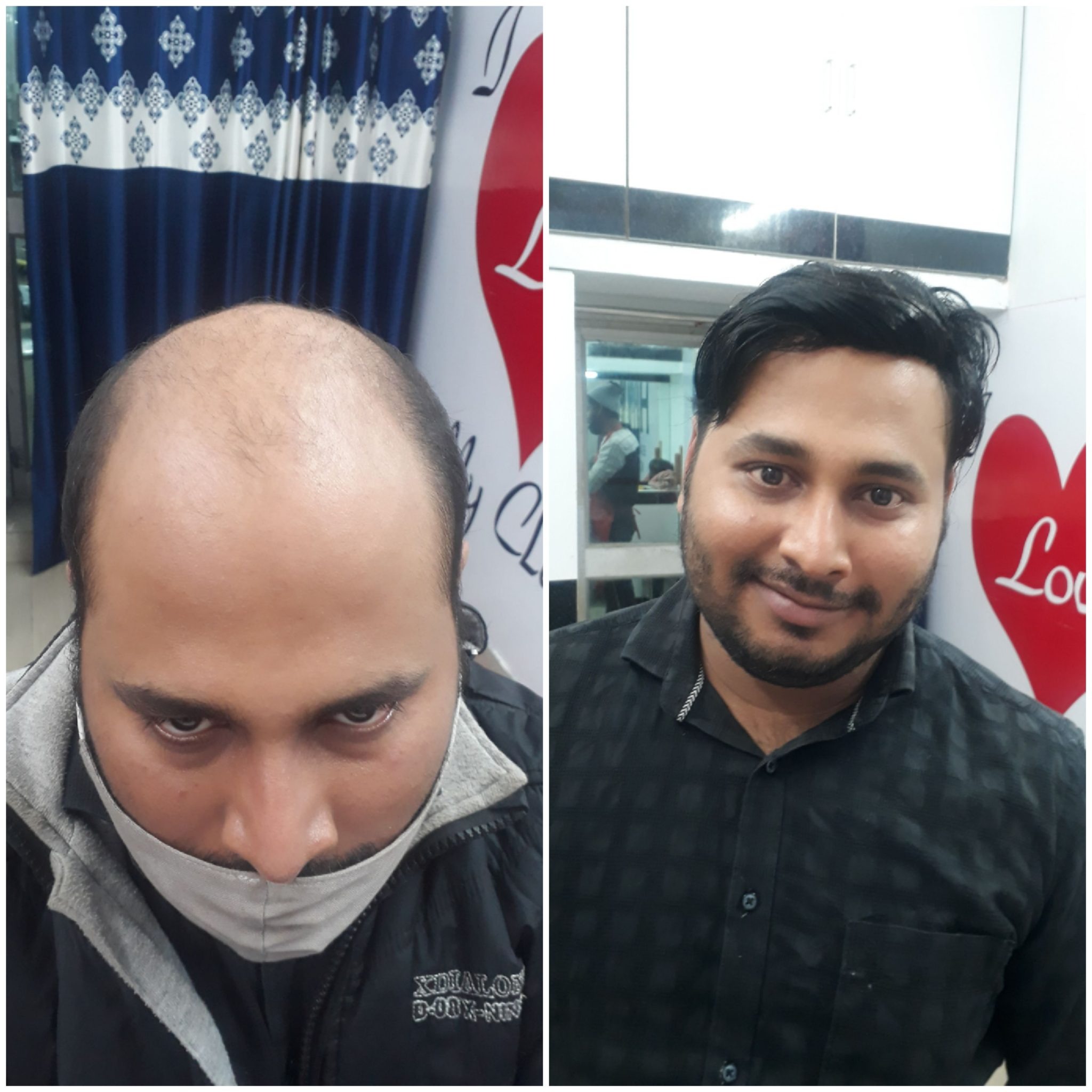 Hair wig result 5