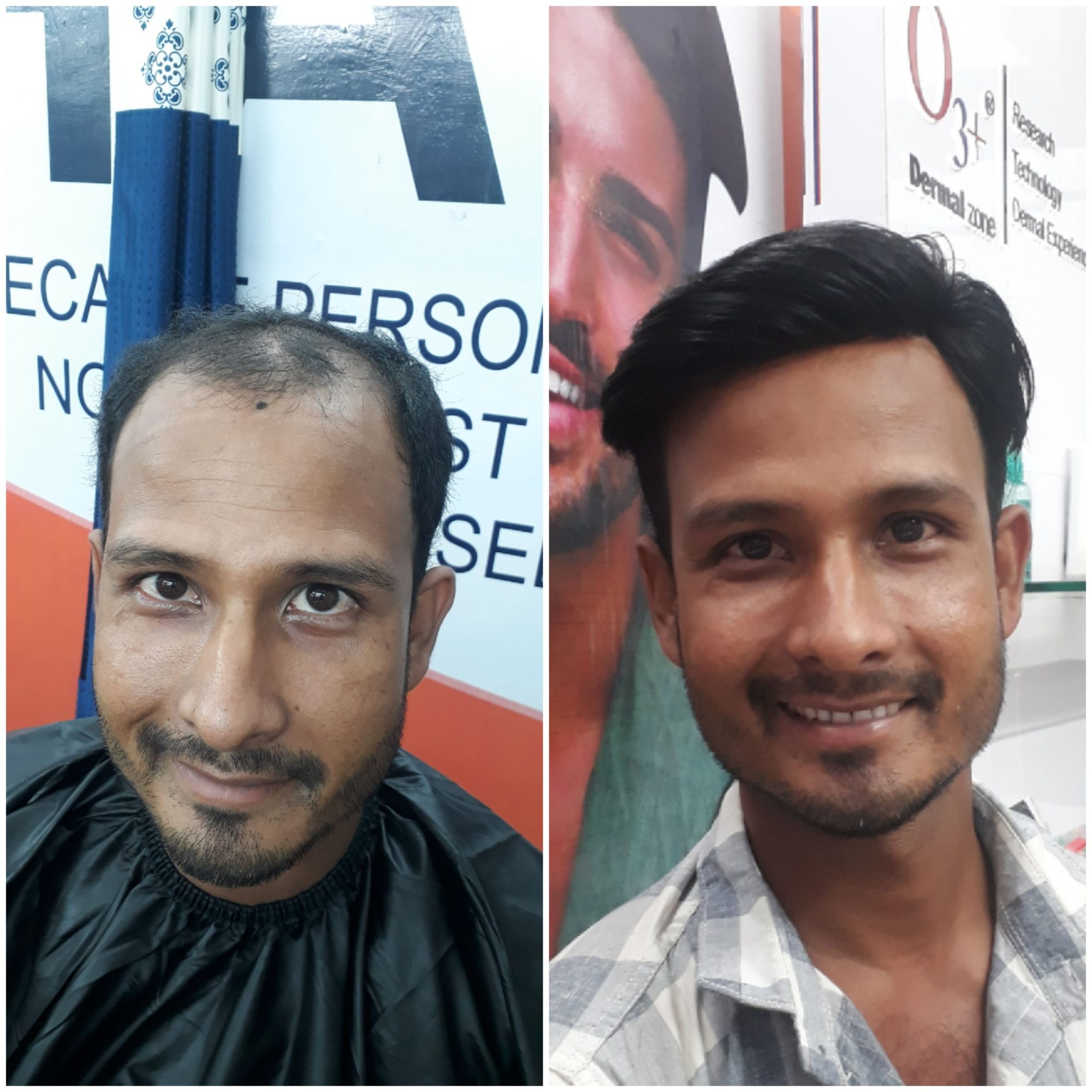 Hair wig result 4