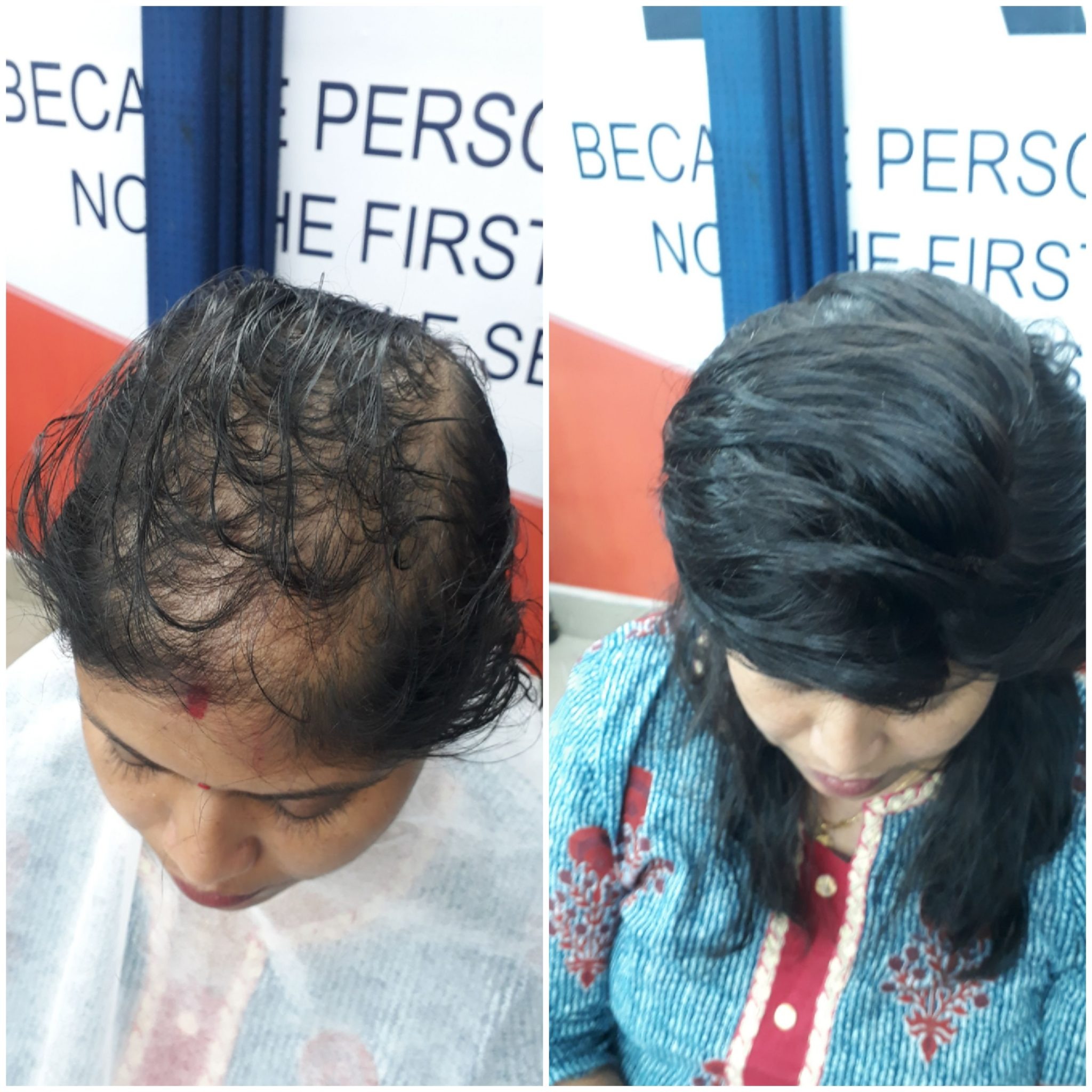 Hair wig result 1
